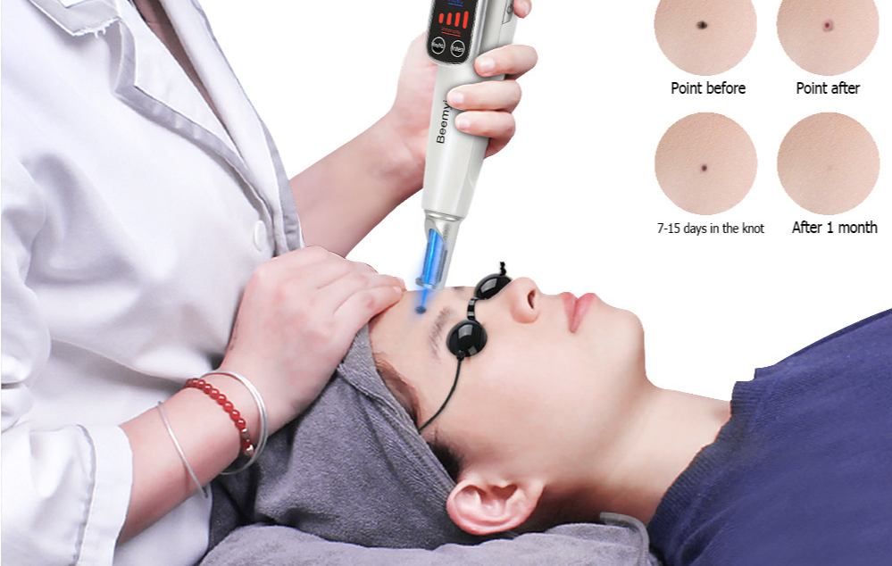 激光祛斑美容仪安全认证(图1) 激光祛斑美容仪安全认证(图1)